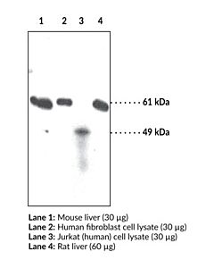 Cayman Soat-2acat-2 Polyclonal Antibody; Size- 1 Ea