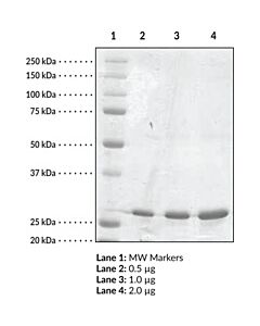 Cayman Serum Retinol Binding Protein 4 (Human Recombinant); Purit