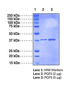 Cayman Prostaglandin F Synthase (Human, Recombinant); Purity- Gre