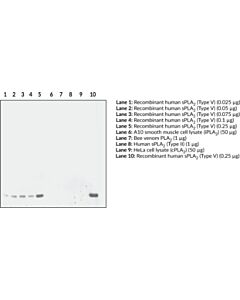 Cayman Spla2 (Mouse Type V) Polyclonal Antibody; Size- 500 Microl