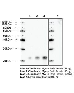 Cayman Citrullinated Myelin Basic Protein Polyclonal Antibody; Si