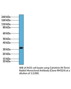 Cayman Calretinin (N-Term) Rabbit Monoclonal Antibody, 100 L