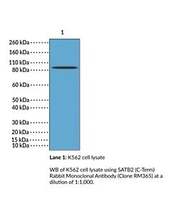 Cayman Satb2 (C-Term) Rabbit Monoclonal Antibody; Size- 100 Μl