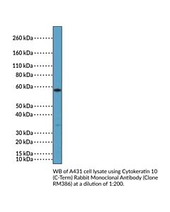 Cayman Cytokeratin 10 (C-Term) Rabbit Monoclonal Antibody; Size-