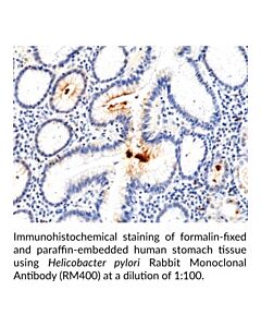 Cayman Helicobacter Pylori Rabbit Monoclonal Antibody; Size- 100