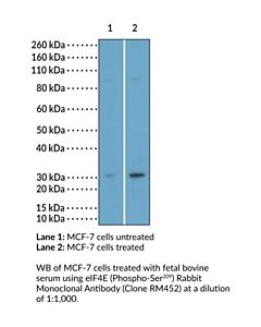 Cayman Eif4e (Phospho-Ser209) Rabbit Monoclonal Antibody, 100ul