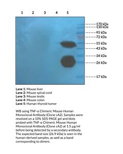 Cayman Tnf-Α Chimeric Mouse-Human Monoclonal Antibody (Clone Ca2); 200 Μg;