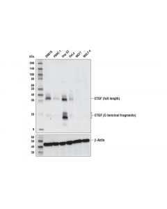 Cell Signaling Ctgf (E2w5m) Rabbit mAb
