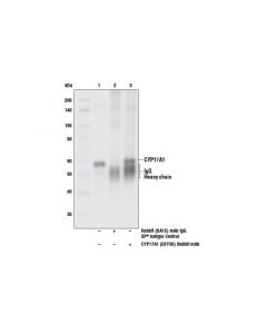 Cell Signaling Cyp17a1 (E6y3s) Rabbit mAb