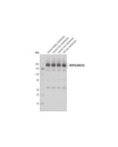 Cell Signaling Mrp6/Abcc6 (D9d1f) Rabbit mAb