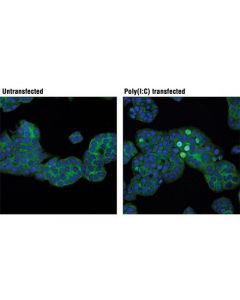 Cell Signaling Irf-3 (D6i4c) Xp Rabbit mAb