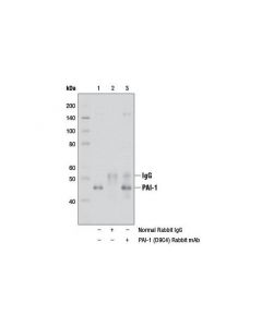 Cell Signaling Pai-1 (D9c4) Rabbit mAb