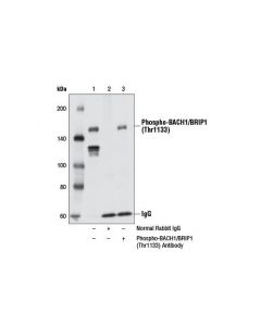 Cell Signaling Phospho-Bach1/Brip1 (Thr1133) Antibody