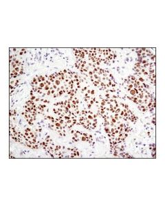 Cell Signaling Hes1 (D6p2u) Rabbit mAb