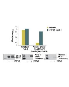 Cell Signaling Pathscan Phospho-Smad2 (Ser465/467)/Smad3 (Ser423/425) Sandwich Elisa Kit