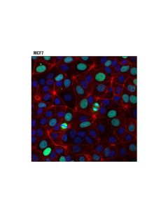 Cell Signaling Tpx2 (D2r5c) Xp Rabbit mAb