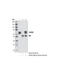 Cell Signaling Card9 Antibody (Mouse Preferred)