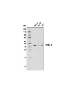 Cell Signaling Protor-2 (D19a5) Rabbit mAb