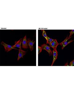 Cell Signaling Fxr1 (D10a2) Xp Rabbit mAb