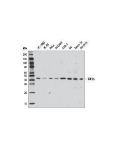 Cell Signaling Ck1delta Antibody