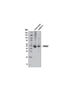 Cell Signaling Pank2 (D11e2) Rabbit mAb (Mouse Specific)