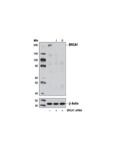 Cell Signaling Signalsilence Brca1 Sirna I