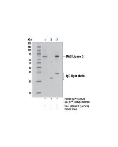 Cell Signaling Dag Lipase Beta (D4p7c) Rabbit mAb