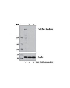 Cell Signaling Signalsilence Fatty Acid Synthase Sirna Ii
