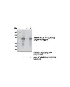Cell Signaling Acetyl-Nf-Kappab P65 (Lys310) (D2s3j) Rabbit mAb