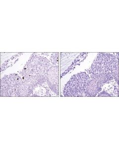 Cell Signaling Signalstain  Apoptosis (Cleaved Caspase-3) Ihc Detection Kit