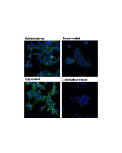 Cell Signaling Acetyl-Coa Carboxylase 1 And 2 Antibody Sampler Kit