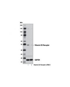 Cell Signaling Signalsilence Vitamin D3 Receptor Sirna I