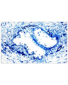 Cell Signaling Signalstain Ultra Blue Alkaline Phosphatase Substrate Kit