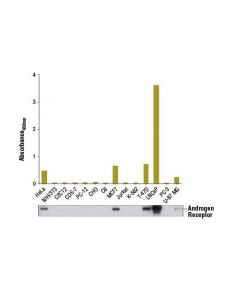 Cell Signaling Pathscan  Total Androgen Receptor Sandwich Elisa Kit