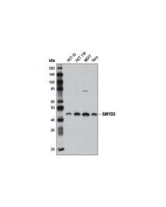 Cell Signaling Smyd3 (D2q4v) Rabbit mAb