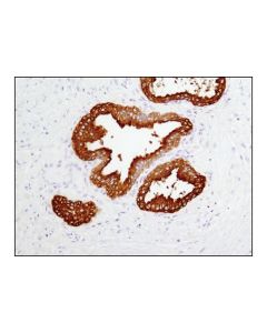 Cell Signaling Prostatic Acid Phosphatase (D3y5p) Rabbit mAb