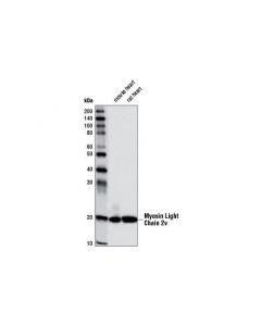 Cell Signaling Myosin Light Chain 2v (D5i1c) (Cardiac Isoform) Rabbit mAb (Rodent Specific)