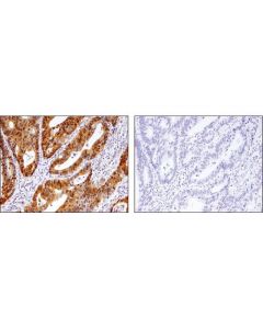 Cell Signaling Phospho-Yap (Ser127) (D9w2i) Rabbit mAb
