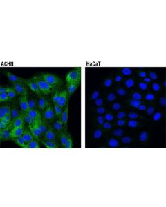 Cell Signaling Sarm1 (D2m5i) Rabbit mAb