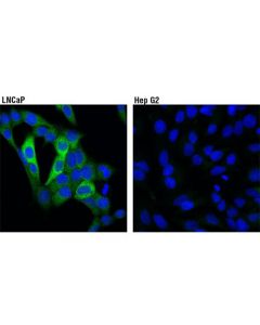 Cell Signaling Pfkfb2 (D5i5f) Rabbit mAb