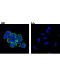 Cell Signaling Rab25 (D4p6p) Xp Rabbit mAb
