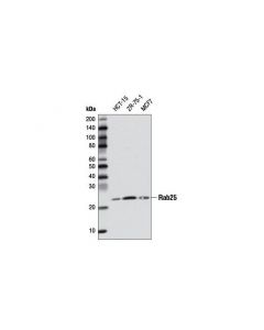 Cell Signaling Rab25 (D3h4n) Rabbit mAb