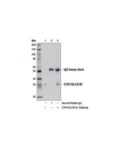 Cell Signaling Ctr1/Slc31a1 Antibody