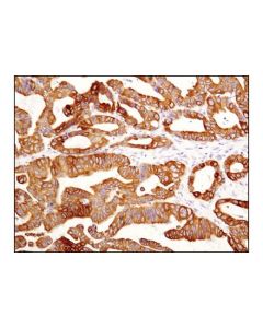 Cell Signaling Keratin 19 (D7f7w) Rabbit mAb