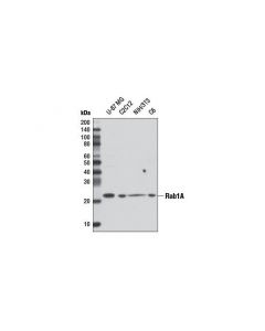 Cell Signaling Rab1a (D5f8m) Rabbit mAb