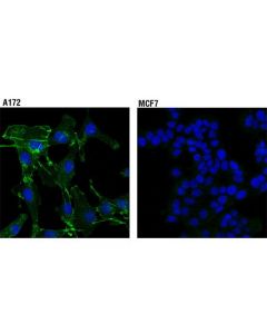 Cell Signaling N-Cadherin (D4r1h) Xp Rabbit mAb