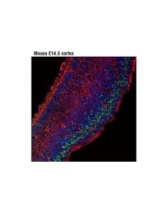 Cell Signaling Neurogenin 2 (D2r3d) Rabbit mAb