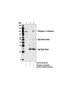 Cell Signaling Phospho-Alpha-E-Catenin (Ser655/Thr658) Antibody