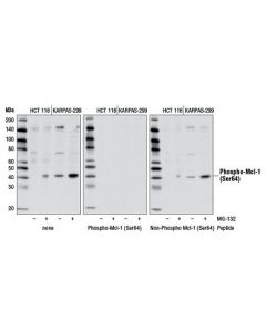 Cell Signaling Phospho-Mcl-1 (Ser64) Antibody