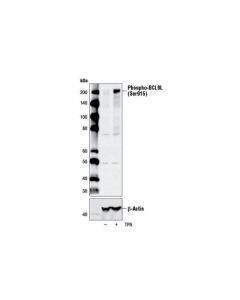 Cell Signaling Phospho-Bcl9l (Ser915) Antibody